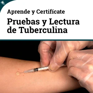 Lectura Tuberculina