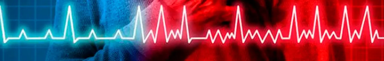 Curso en Diagnóstico y Manejo de Arritmias y Estimulación Cardíaca