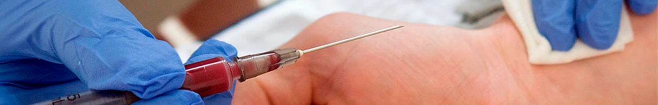 Curso Gasometria Avanzado en Interpretación y Aplicación Clínica
