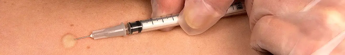 Curso de Certificación en Administración y Lectura de Pruebas de Tuberculina