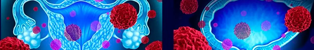 Curso Integral: Virus del Papiloma Humano (VPH) - Abordaje Clínico y Epidemiológico